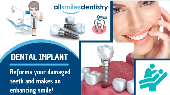 comprehensive dentistry options to replace your missing teeth