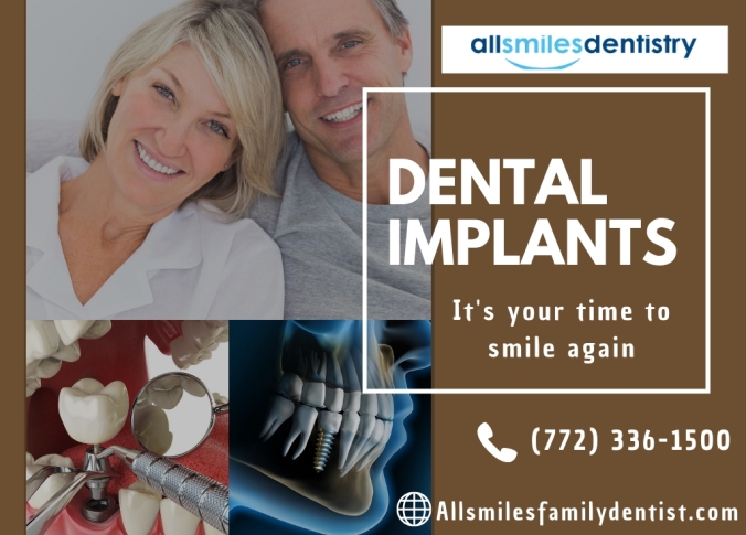 Trusted Dental Implants Specialist